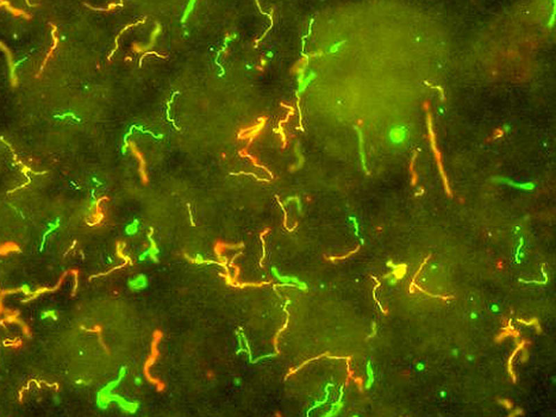 Lajmska bolest liječi se antibioticima kroz duži period, a ukoliko je došlo do ozbiljnijih komplikacija neophodna je i hospitalizacija